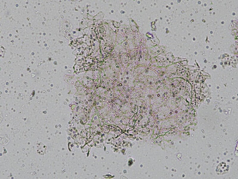 Nấm da đầu thường do nấm dermatophytes gây ra và dễ phát triển trong môi trường ẩm, bí hoặc vệ sinh kém. 